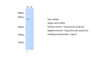 BRD3 Rabbit Polyclonal Antibody