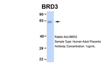 BRD3 Rabbit Polyclonal Antibody