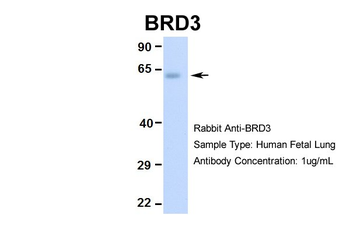 BRD3 Rabbit Polyclonal Antibody