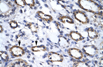 APG4B Rabbit Polyclonal Antibody