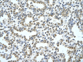 APG4B Rabbit Polyclonal Antibody