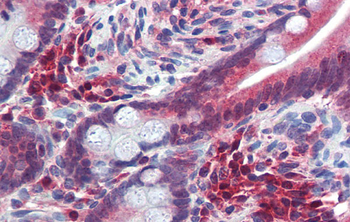 TRIM35 Rabbit Polyclonal Antibody