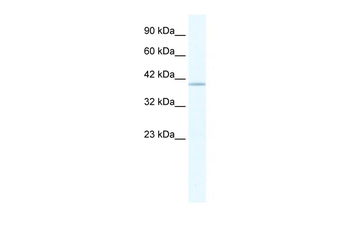 TRIM68 Rabbit Polyclonal Antibody