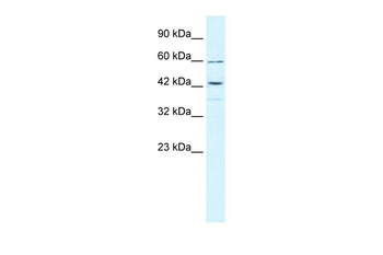 TRIM68 Rabbit Polyclonal Antibody