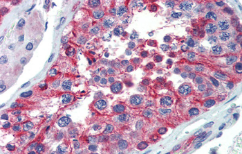 LIN28 Rabbit Polyclonal Antibody