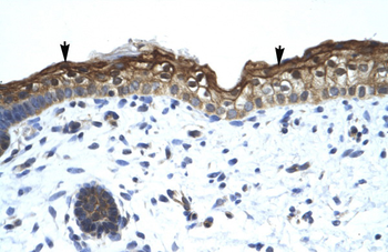 SMARCA2 Rabbit Polyclonal Antibody