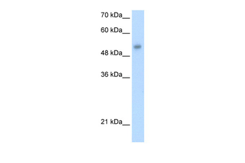 ONECUT3 Rabbit Polyclonal Antibody