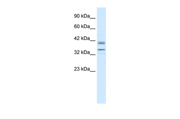 ONECUT3 Rabbit Polyclonal Antibody
