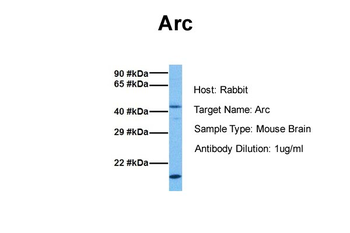 Arc Rabbit Polyclonal Antibody