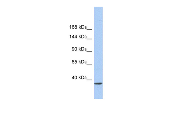 SMARCAD1 Rabbit Polyclonal Antibody