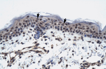 TAF9 Rabbit Polyclonal Antibody