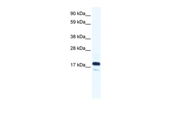 TAF9 Rabbit Polyclonal Antibody