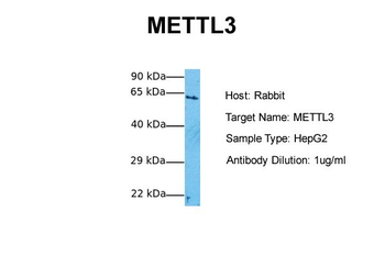 METTL3 Rabbit Polyclonal Antibody