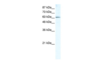 METTL3 Rabbit Polyclonal Antibody