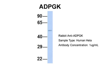 ADPGK Rabbit Polyclonal Antibody