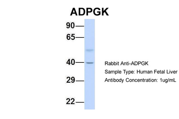 ADPGK Rabbit Polyclonal Antibody