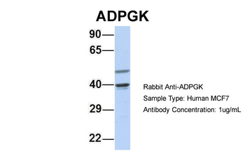 ADPGK Rabbit Polyclonal Antibody