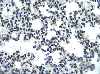 PSIP1 Rabbit Polyclonal Antibody