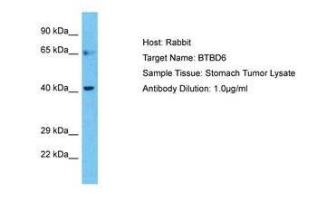 BTBD6 Rabbit Polyclonal Antibody