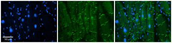 AMOT Rabbit Polyclonal Antibody