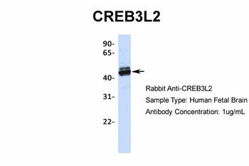 CREB3L2 Rabbit Polyclonal Antibody