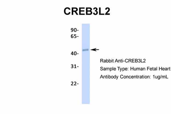 CREB3L2 Rabbit Polyclonal Antibody
