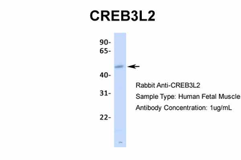 CREB3L2 Rabbit Polyclonal Antibody