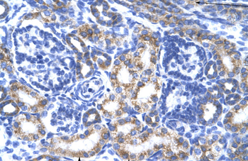 CREB3L2 Rabbit Polyclonal Antibody