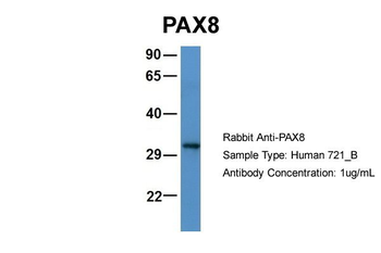 PAX5 Rabbit Polyclonal Antibody