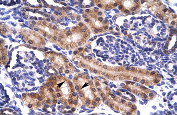 PAX5 Rabbit Polyclonal Antibody