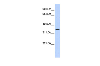 TRIM27 Rabbit Polyclonal Antibody