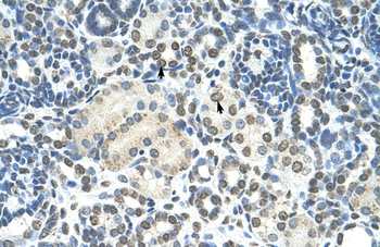 ZMYND11 Rabbit Polyclonal Antibody