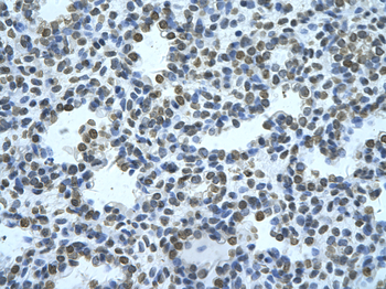 ZMYND11 Rabbit Polyclonal Antibody