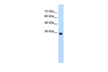 ZMYND11 Rabbit Polyclonal Antibody