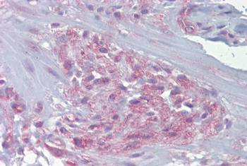 FREQ Rabbit Polyclonal Antibody