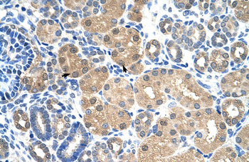 KEAP1 Rabbit Polyclonal Antibody