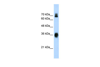 KEAP1 Rabbit Polyclonal Antibody