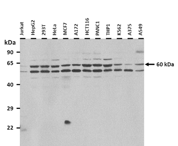 TRIM39 Rabbit Polyclonal Antibody