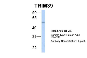 TRIM39 Rabbit Polyclonal Antibody
