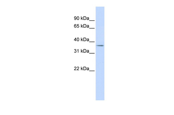 TRIM69 Rabbit Polyclonal Antibody