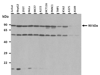 UHRF2 Rabbit Polyclonal Antibody
