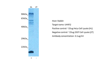 UHRF2 Rabbit Polyclonal Antibody