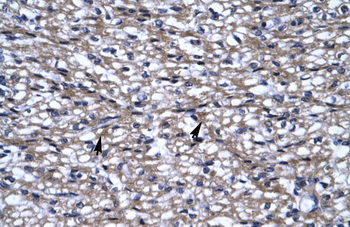 UHRF2 Rabbit Polyclonal Antibody