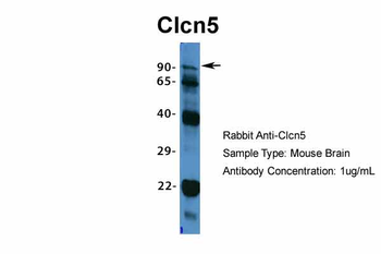 Clcn5 Rabbit Polyclonal Antibody