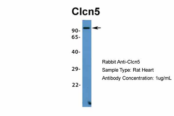 Clcn5 Rabbit Polyclonal Antibody