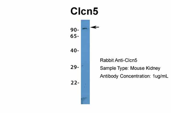 Clcn5 Rabbit Polyclonal Antibody
