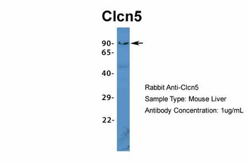 Clcn5 Rabbit Polyclonal Antibody