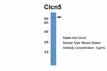 Clcn5 Rabbit Polyclonal Antibody
