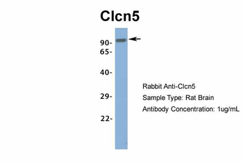 Clcn5 Rabbit Polyclonal Antibody
