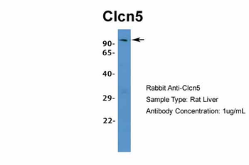 Clcn5 Rabbit Polyclonal Antibody